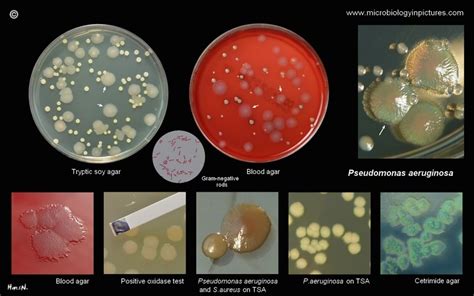 Pseudomonas aeruginosa morphology, growth characteristics an.